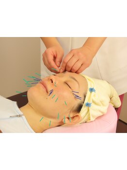 小顔になりたい