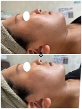 プリマプリート 大垣店/二重アゴ撃退！