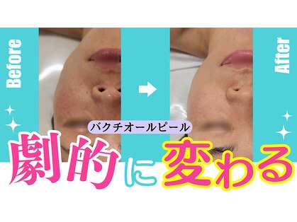 リアン(Lien)の写真