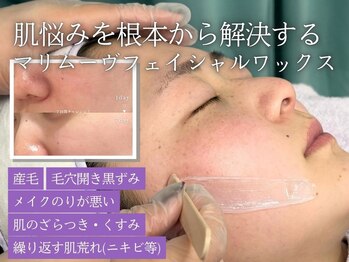 マリーブ 恵比寿本店(MAREVE)の写真/【人気No1！美肌フェイスワックス脱毛】そのつるつるの仕上がりに感動！ムダ毛除去だけでなく美肌効果も！