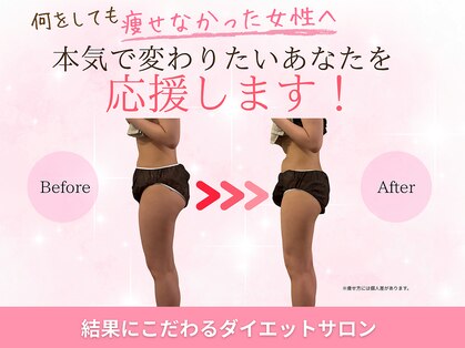ヨサパーク ビーチ 花畑店(YOSA PARK BEACH)の写真