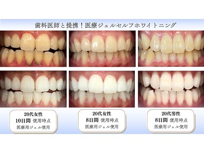 エイトバイエイト(8×8)の写真