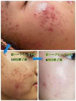 ウル(Ulu)の写真/【看護師スタッフ在籍】丁寧なカウンセリングで健康相談も可能☆お悩みに合わせたケアをご提案いたします！