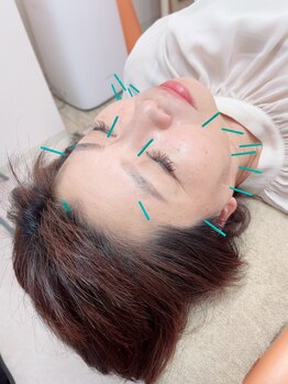 ヒーリングサロン アージュ(A-je)/★美顔鍼＋小顔矯正★