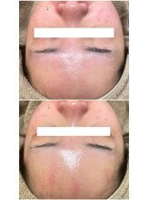 モンクラッシー(Mon classy)/