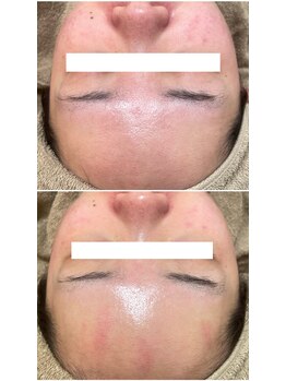 モンクラッシー(Mon classy)/