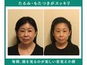 【人気No.2】鏡を見たくない口元のもたつき/目元たるみ改善/二重あごスッキリ