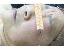 エスティフル 狭山店(ESTIFUL)/Before/フェイシャル/マッサージ