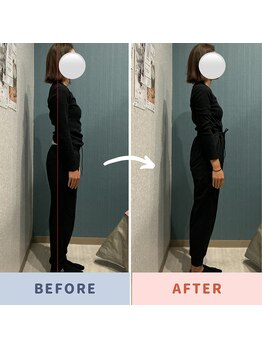 ゆるる(Yururu)/ビフォーアフター(全身矯正)