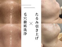 ケアナ 麻布十番店(CareNa)