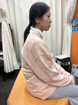 オハナ接骨院 鍼灸院 初芝駅前院(Ohana接骨院 鍼灸院)/施術前