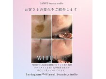 ラヌイ(LANUI)の雰囲気（WHITELAB認定講師オーナーが施術♪シミのお悩みはお任せ下さい◎）