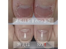 ヘアーアンドネイル フレンチ(French)の雰囲気（しっかり爪が縦長、美爪へ変化してます！体験してみてください！）