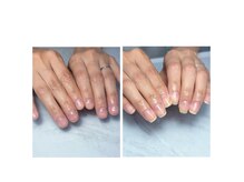 シフォンネイル(Shifon.nail_)の雰囲気（美爪育成★深爪・むしり癖緩和クリアジェル￥5000→￥4000）