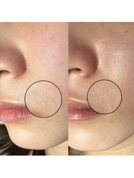 ネイル&アイラッシュ ルミア(Nail & Eyelash LUMIA)/～LumiAフォトギャラリー～