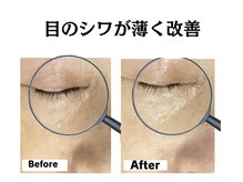 グレースティー 森町 箕面/年齢の出る目元のハリアップ