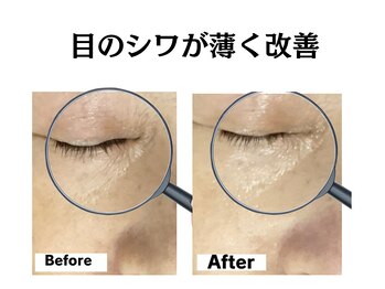 グレースティー 森町 箕面/年齢の出る目元のハリアップ