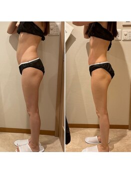 リラクゼーション モアナヴィラ(MOANA VILLA)/痩身エステ　ビフォーアフター