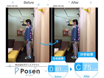宮前まちの整骨院 宮前まちの鍼灸マッサージ院/AI診断【骨盤矯正/整体/宮前】