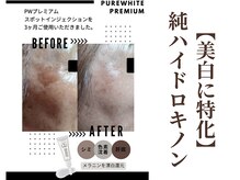 グラシーズ(Glasses)/ケア・改善・緩和・お悩みの方へ