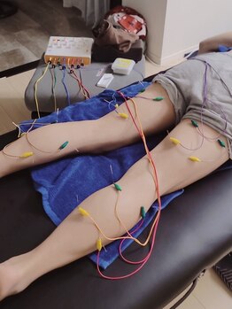 創整はりきゅう院の写真/【大通/狸小路すぐ】鍼やこだわり手技を掛け合わせ足だけでなく全身状態を改善!むくみの原因を根本から解消