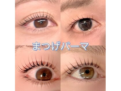 シュピネ(Choupinet)の写真