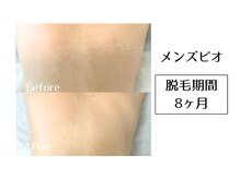 メンズビオ 神戸三宮店/