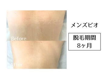 メンズビオ 神戸三宮店/