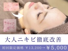 フェイシャル専門店 エピア 掛川店(Epia)