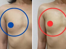 ポインセチア(Poinsettia)/体型/体質を選ばないバストUP