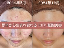 ユウビジン(YOU美人)/隠す肌から魅せる肌へ