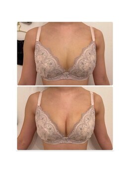 フラフィ 宇都宮本店(fluffy)/離れバストもボリュームアップ♪