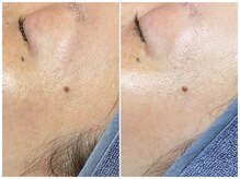 フラックス 京都(FLUX)の雰囲気（納得出来る効果実感で“毛穴レス大人艶肌”へ♪）