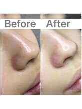 プルティティア 池下 今池 覚王山(Pultitia)/