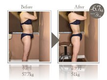 ビューティーリバース 新横浜店/★劇的ビフォーアフター★