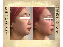 サンテボーテ(Sante Beaute)