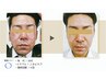【メンズニキビケア】肌改善バクテリウムピール☆毛穴/毛穴黒ずみ悩みに◎