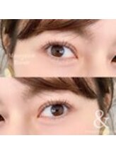 アンド 南草津店(&)/フラットラッシュ 