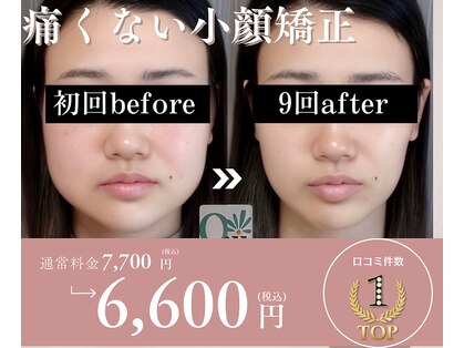 キュープ 福岡天神店(Qpu)の写真