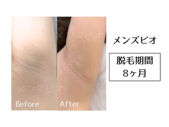 メンズビオ 神戸三宮店/