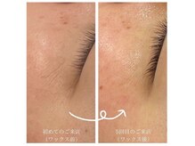 ここはな/小じわが薄くなります。