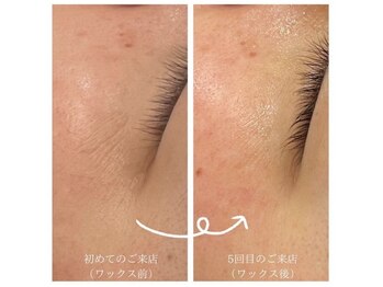 ここはな/小じわが薄くなります。