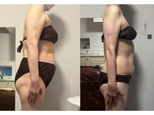 プリマヴェーラ/お腹ほぐすと腰痛改善します