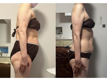 プリマヴェーラ/お腹ほぐすと腰痛改善します