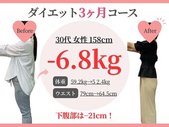 幸楽整骨院の写真/【今年こそ本気で痩せたい方へ！】無理な食事制限、運動無しで理想の自分を目指す！