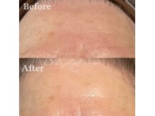 ベルアイラッシュ(Belleyelash)/【フェイシャルワックス】