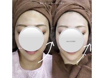 ウルス(ulus)/LC式美輪郭小顔