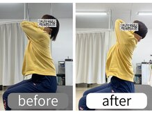 ナオル整体 大里院(NAORU整体)/50代女性　背中を反る動作