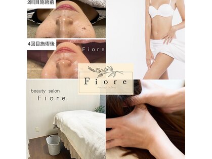 フィオーレ(Fiore)の写真