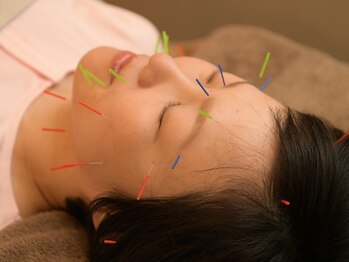 かすがい鍼灸院リハート(Re.heart)/美容鍼